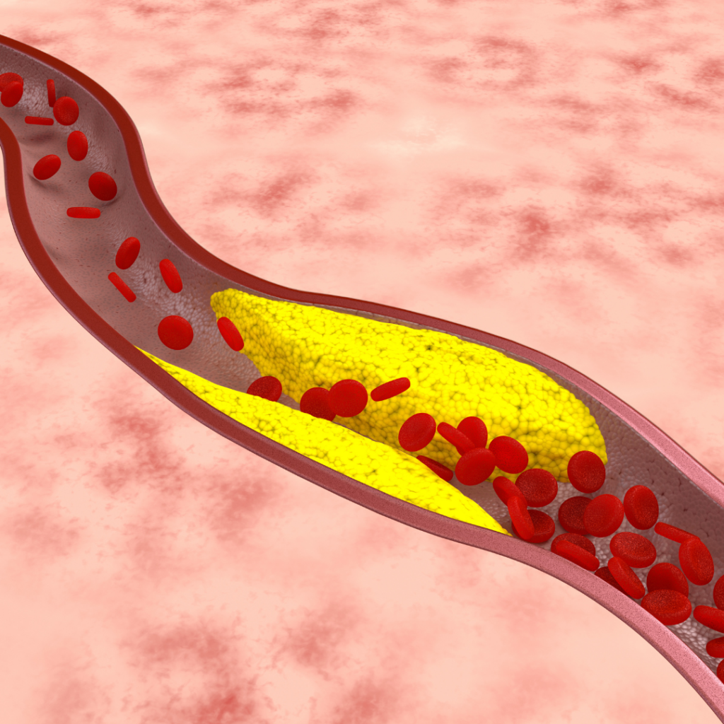 χοληστερόλη cholesterol