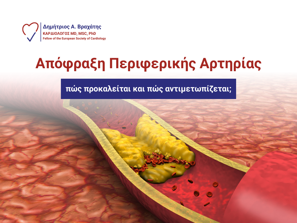 απόφραξη περιφερικής αρτηρίας cover
