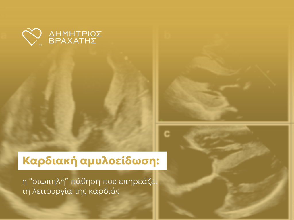 καρδιακή αμυλοείδωση cover