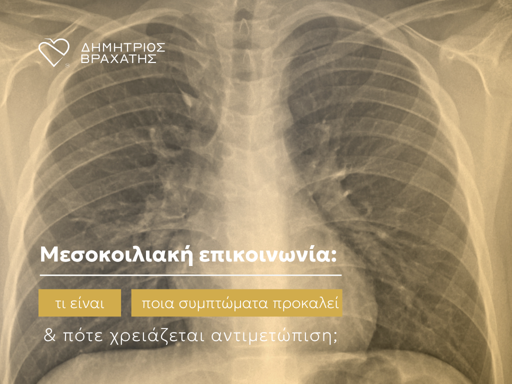μεσοκοιλιακή επικοινωνία cover