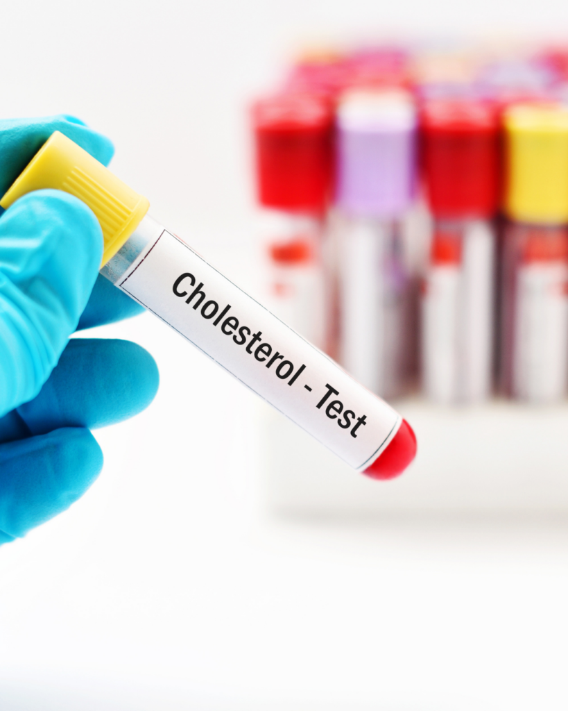 LDL χοληστερίνη cholesterol test tube